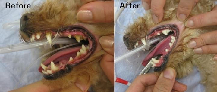 歯石除去治療前後の写真